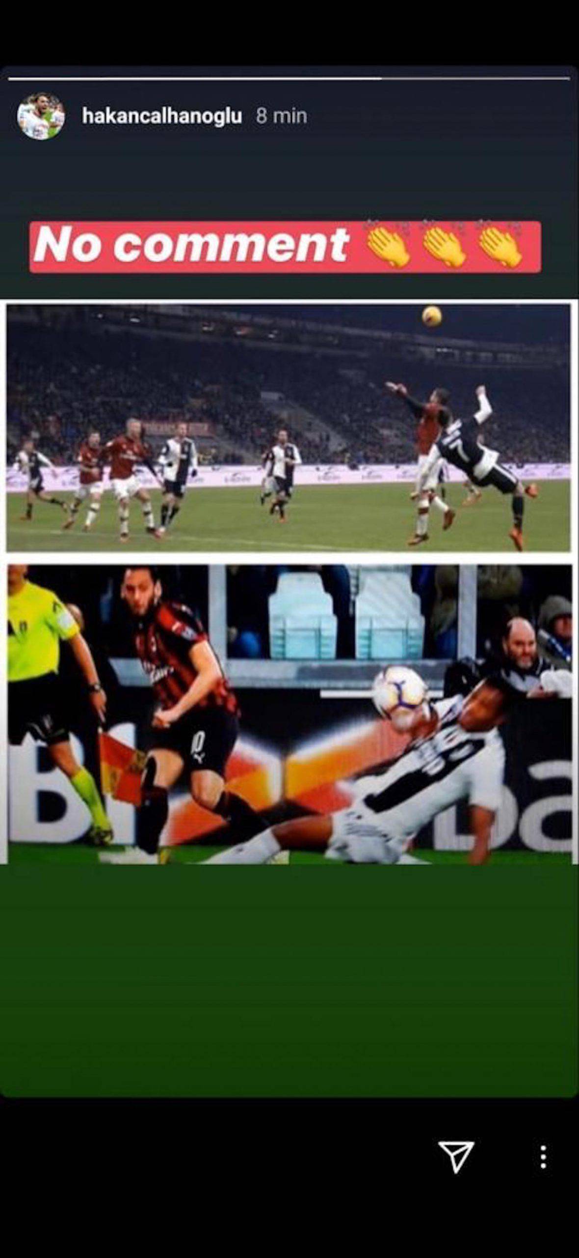 Milan-Juventus, Calhanoglu polemico dopo il mani di Alex Sandro
